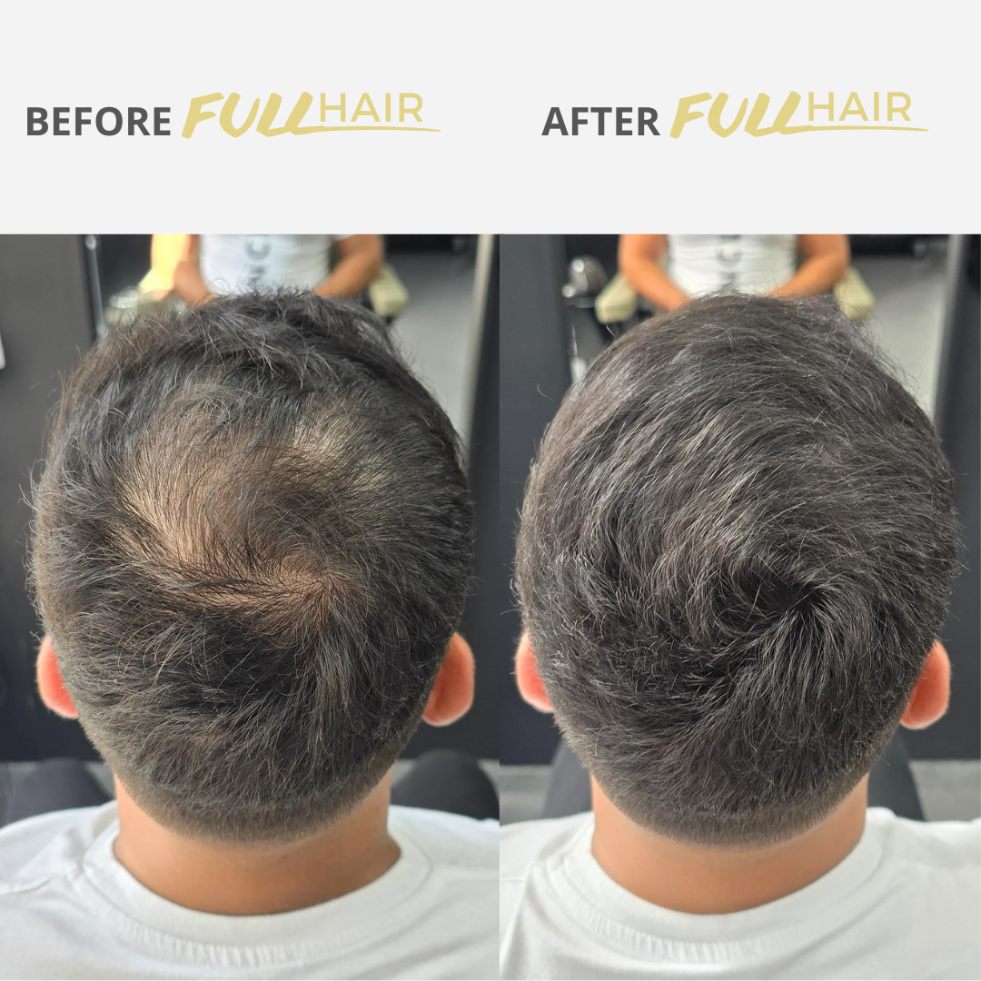Fullhair – Instantly conceals thinning hair