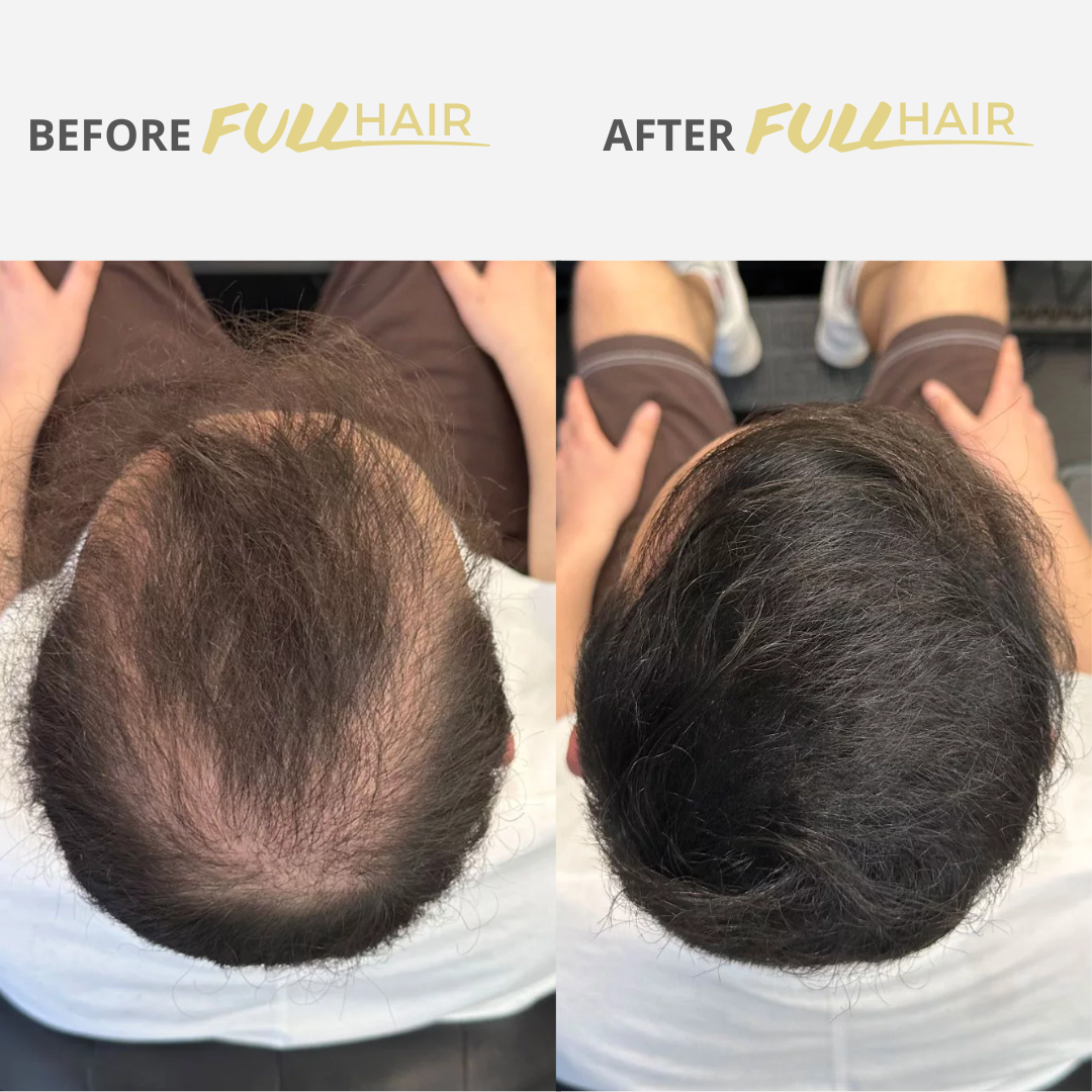 Fullhair – Instantly conceals thinning hair